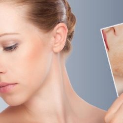 Cum sa tratezi un ten sensibil