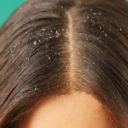 Cum sa scapi mai usor de matreata